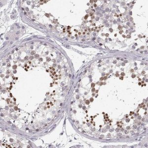 Anti-OIP5 antibody produced in rabbit HPA059602-100UL
