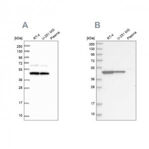 Anti-OLA1 antibody produced in rabbit HPA041443-100UL