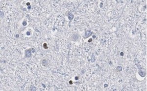 Anti-Olig2 Antibody, clone 211F1.1 ZooMAb Mouse Monoclonal 