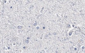 Anti-Olig2 Antibody, clone 211F1.1 ZooMAb Mouse Monoclonal 