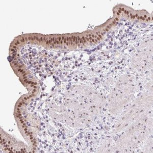 Anti-ONECUT2 antibody produced in rabbit 
