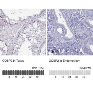 Anti-OOSP2 antibody produced in rabbit 