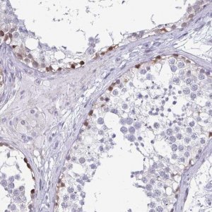 Anti-OOSP2 antibody produced in rabbit 