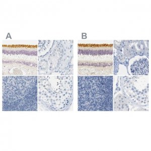 Anti-OPN1SW antibody produced in rabbit 