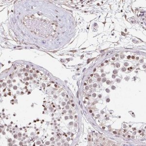 Anti-ORC3 antibody produced in rabbit 