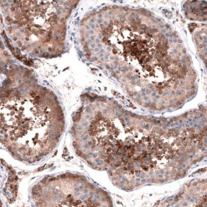 Anti-OSBP2 antibody produced in rabbit 