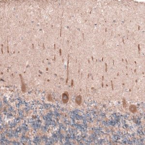 Anti-OSBP2 antibody produced in rabbit 