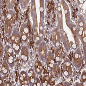 Anti-OSBPL2 antibody produced in rabbit 