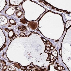 Anti-OSBPL5 antibody produced in rabbit 