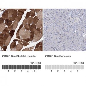 Anti-OSBPL6 antibody produced in rabbit 