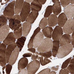 Anti-OSBPL6 antibody produced in rabbit 