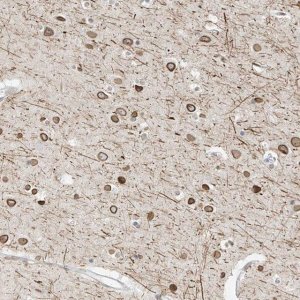Anti-OSBPL7 antibody produced in rabbit 
