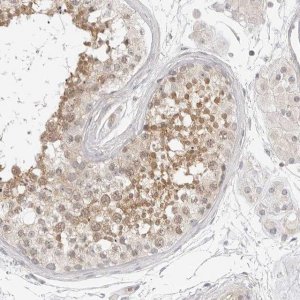 Anti-OSCP1 antibody produced in rabbit 
