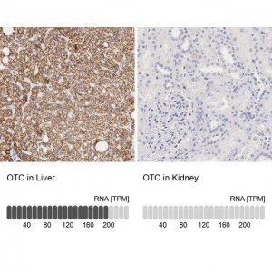 Anti-OTC antibody produced in rabbit 