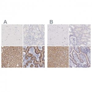 Anti-OTC antibody produced in rabbit 