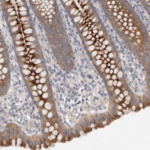 Anti-OTOR antibody produced in rabbit 
