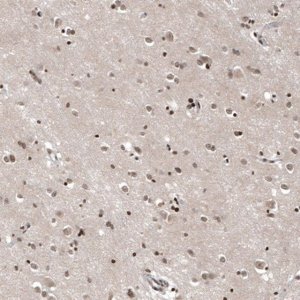 Anti-OTUB1 antibody produced in rabbit 