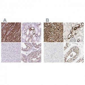 Anti-OXCT1 antibody produced in rabbit 