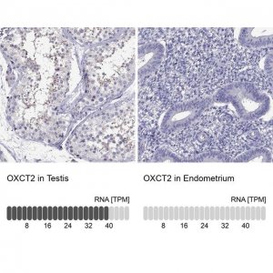 Anti-OXCT2 