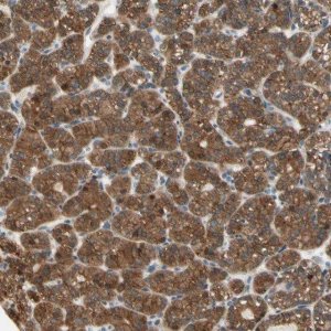 Anti-OXSR1 antibody produced in rabbit HPA008237-100UL