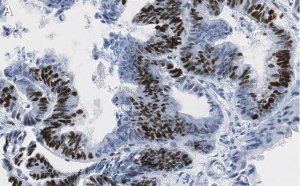Anti-p-4E-BP1 (Thr37/46) Antibody, clone 1N7 ZooMAb Rabbit Monoclonal 