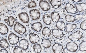 Anti-p-histone H2A (Ser139) Antibody, clone JBW301 ZooMAb Mouse Monoclonal 