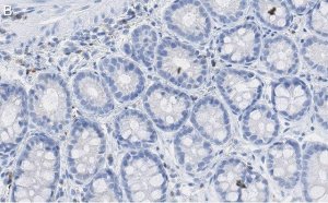 Anti-p-histone H2A (Ser139) Antibody, clone JBW301 ZooMAb Mouse Monoclonal 