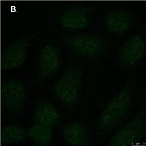 Anti-p-Ubiquitin (pSer65) Antibody, clone 2N21 ZooMAb Rabbit Monoclonal 