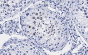 Anti-p14ARF Antibody, clone 4F19 ZooMAb Rabbit Monoclonal 