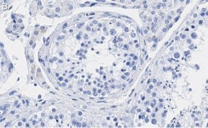 Anti-p14ARF Antibody, clone 4F19 ZooMAb Rabbit Monoclonal 