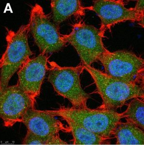 Anti-p16 Antibody, clone D25 ZooMAb Mouse Monoclonal 