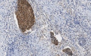 Anti-p16-INK4a Antibody, clone 5F22 Antibody, ZooMAb Rabbit Monoclonal 