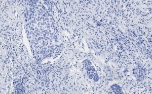 Anti-p16-INK4a Antibody, clone 5F22 Antibody, ZooMAb Rabbit Monoclonal 