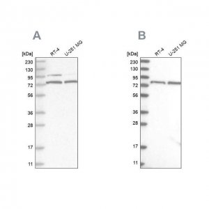 Anti-P2RX7 antibody produced in rabbit 