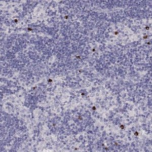 Anti-P2RY10 antibody produced in rabbit 