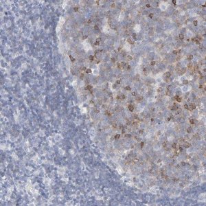 Anti-P2RY8 antibody produced in rabbit 