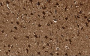 Anti-p44 MAPK (ERK1) Antibody, clone 13F10, ZooMAb Rabbit Monoclonal 
