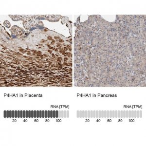 Anti-P4HA1 antibody produced in rabbit 