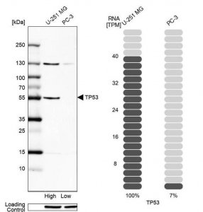 Anti-p53 antibody produced in rabbit 