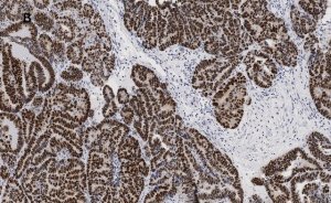 Anti-p53 Antibody, clone 6O23, ZooMAb Rabbit Monoclonal 