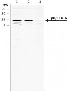 Anti-p8/TTD-A (C-terminal) antibody produced in rabbit 