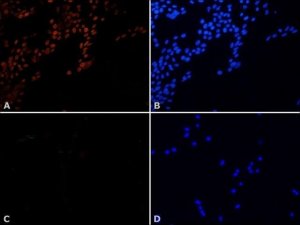 Anti-p8/TTD-A (N-terminal) antibody produced in rabbit 