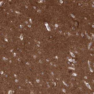 Anti-PACS1 antibody produced in rabbit 