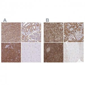 Anti-PACSIN2 antibody produced in rabbit HPA049854-100UL