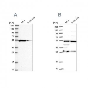 Anti-PACSIN3 antibody produced in rabbit 