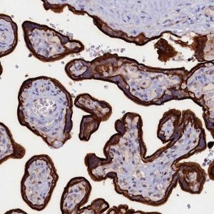 Anti-PACSIN3 antibody produced in rabbit 