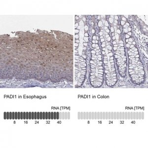 Anti-PADI1 antibody produced in rabbit 