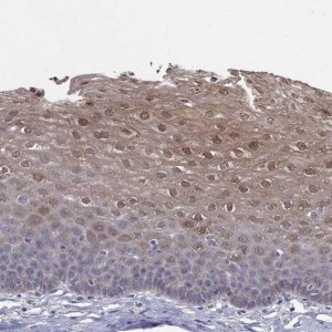 Anti-PADI1 antibody produced in rabbit 