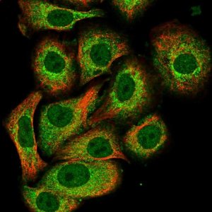 Anti-PADI3 antibody produced in rabbit 