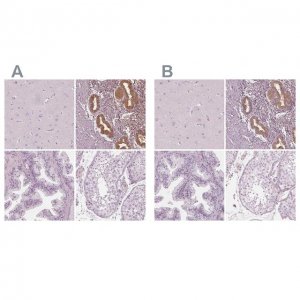 Anti-PAEP antibody produced in rabbit 